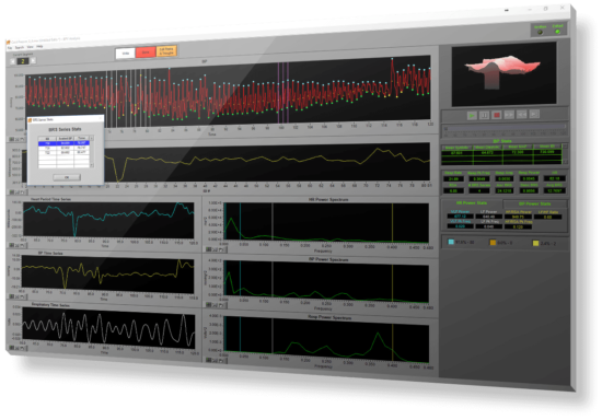 BPV Analysis Software Subscription - Image 3