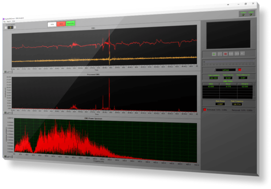 EMG Analysis Application - Image 4