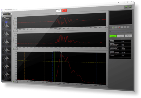 EMG Analysis Application - Image 3